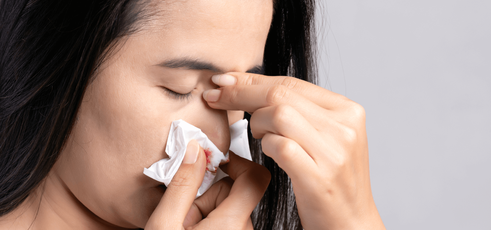 Bleeding Nose An Unusual Anxiety Symptom