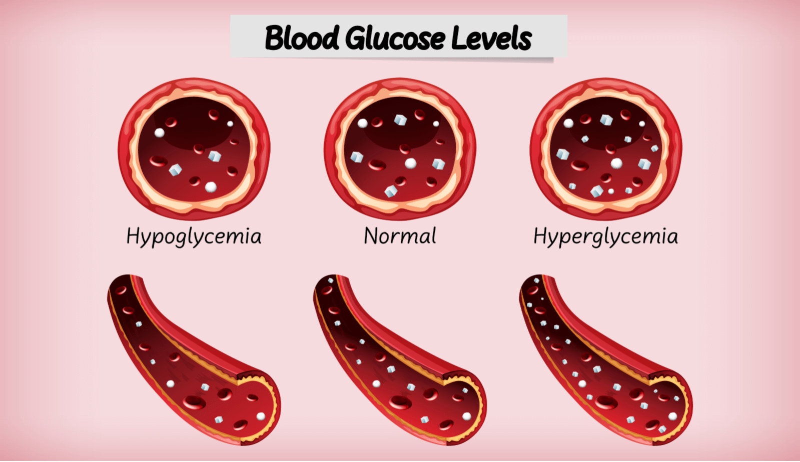 How To Recognize And Treat Hypoglycemia Related Anxiety